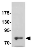 Anti-DRP1 antibody used in Western Blot (WB). GTX31901