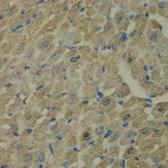 Anti-CCBL1 antibody used in IHC (Paraffin sections) (IHC-P). GTX32492