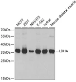 Anti-LDHA antibody used in Western Blot (WB). GTX32701