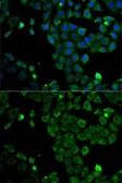 Anti-MSR1 antibody used in Immunocytochemistry/ Immunofluorescence (ICC/IF). GTX32729