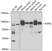 Anti-PTPRE antibody used in Western Blot (WB). GTX32824