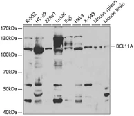 Anti-Ctip1 antibody used in Western Blot (WB). GTX33126