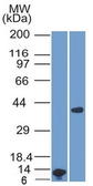 Anti-Arginase 1 antibody [ARG1/1125] used in Western Blot (WB). GTX34415