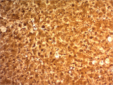 Anti-Arginase 1 antibody [ARG1/1126] used in IHC (Paraffin sections) (IHC-P). GTX34416
