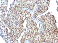 Anti-Estrogen Receptor beta antibody [ESR2/686] used in IHC (Paraffin sections) (IHC-P). GTX34712