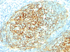 Anti-VCAM1 / CD106 antibody [1.4C3] used in IHC (Paraffin sections) (IHC-P). GTX35158