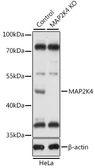 Anti-SEK1 / MKK4 antibody used in Western Blot (WB). GTX35224