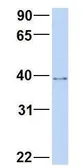 Anti-A2BP1 antibody, N-term used in Western Blot (WB). GTX44870