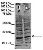 Anti-INSIG1 antibody, Internal used in Western Blot (WB). GTX47438