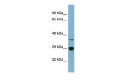 Anti-BDH2 antibody, Internal used in Western Blot (WB). GTX48922