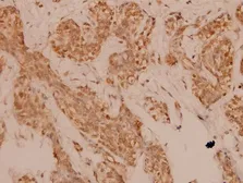 Anti-FRA2 antibody used in IHC (Paraffin sections) (IHC-P). GTX49376