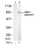 Anti-HSF1 (phospho Ser307) antibody used in Western Blot (WB). GTX50239