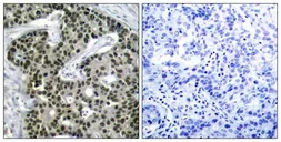 Anti-HSF1 (phospho Ser303) antibody used in IHC (Paraffin sections) (IHC-P). GTX50288