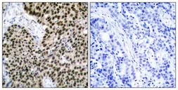 Anti-HSF1 antibody used in IHC (Paraffin sections) (IHC-P). GTX50576
