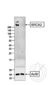 Anti-BRCA2 antibody used in Western Blot (WB). GTX51235