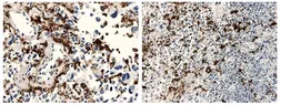 Anti-Macrophage antibody [11H3] used in IHC (Paraffin sections) (IHC-P). GTX53120