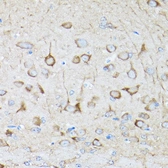 Anti-DRP1 antibody used in IHC (Paraffin sections) (IHC-P). GTX54040
