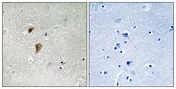 Anti-HSF1 (phospho Thr142) antibody used in IHC (Paraffin sections) (IHC-P). GTX55327