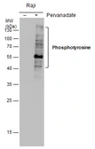 Anti-Phosphotyrosine antibody [GT0021] used in Western Blot (WB). GTX630143