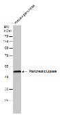pancreatic lipase antibody [gt1777]