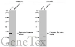 Anti-Estrogen Receptor alpha antibody [HL1081] used in Western Blot (WB). GTX636202