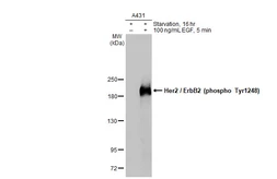 Anti-Her2 / ErbB2 (phospho Tyr1248) antibody [HL1466] used in Western Blot (WB). GTX636940