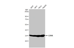 Anti-LDHA antibody [HL2615] used in Western Blot (WB). GTX639069