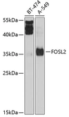 Anti-FRA2 antibody used in Western Blot (WB). GTX64443