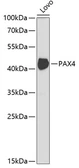 Anti-PAX4 antibody used in Western Blot (WB). GTX64523