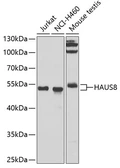 Anti-Hice1 antibody used in Western Blot (WB). GTX65898