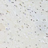 Anti-CTCF antibody used in IHC (Paraffin sections) (IHC-P). GTX65930