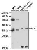 Anti-DLX5 antibody used in Western Blot (WB). GTX66325