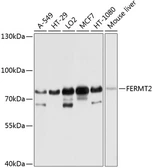 Anti-Mig-2 antibody used in Western Blot (WB). GTX66540