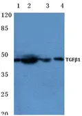 Anti-TGF beta 1 antibody used in Western Blot (WB). GTX66628