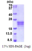 Human IL9 protein, His tag. GTX67498-pro