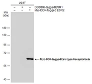Anti-Estrogen Receptor beta antibody [6A12] used in Western Blot (WB). GTX70178