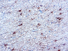 Anti-GFAP antibody [GA5] used in IHC (Paraffin sections) (IHC-P). GTX73615