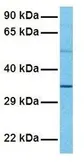 Anti-PAX4 antibody, Internal used in Western Blot (WB). GTX77866