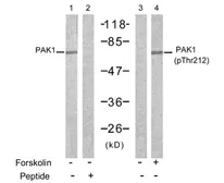Anti-PAK1 (phospho Thr212) antibody used in Western Blot (WB). GTX78974