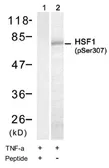 Anti-HSF1 (phospho Ser307) antibody used in Western Blot (WB). GTX79052