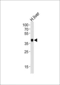 Anti-HAO1 antibody, Internal used in Western Blot (WB). GTX81144