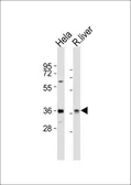 Anti-PAX4 antibody, Internal used in Western Blot (WB). GTX81771