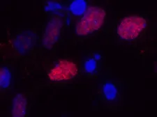 Anti-OLIG2 antibody used in Immunocytochemistry/ Immunofluorescence (ICC/IF). GTX82620