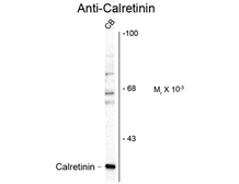 Anti-Calretinin antibody used in Western Blot (WB). GTX82731