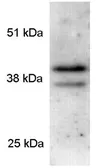 Anti-PAR4 antibody used in Western Blot (WB). GTX82874