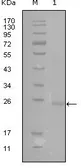 Anti-GATA3 antibody [1A10D1] used in Western Blot (WB). GTX83047