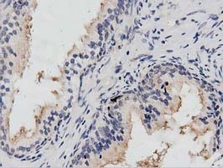 Anti-PTPRE antibody [2A9] used in IHC (Paraffin sections) (IHC-P). GTX83761