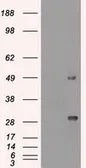 Anti-Ki67 antibody [3D11] used in Western Blot (WB). GTX84107