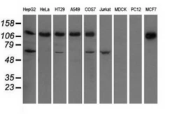 Anti-IGF2BP2 antibody [4F7] used in Western Blot (WB). GTX84309
