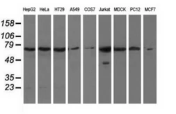 Anti-HAO1 antibody [3E7] used in Western Blot (WB). GTX84392